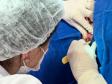 HDS - Mutirão de consultas dermatológicas no HRL