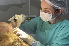 HDS - Tratamento alopecia - 2026