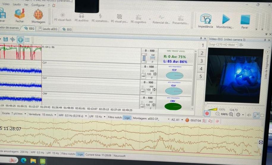 HRS - UTI Neonatal Neurológica