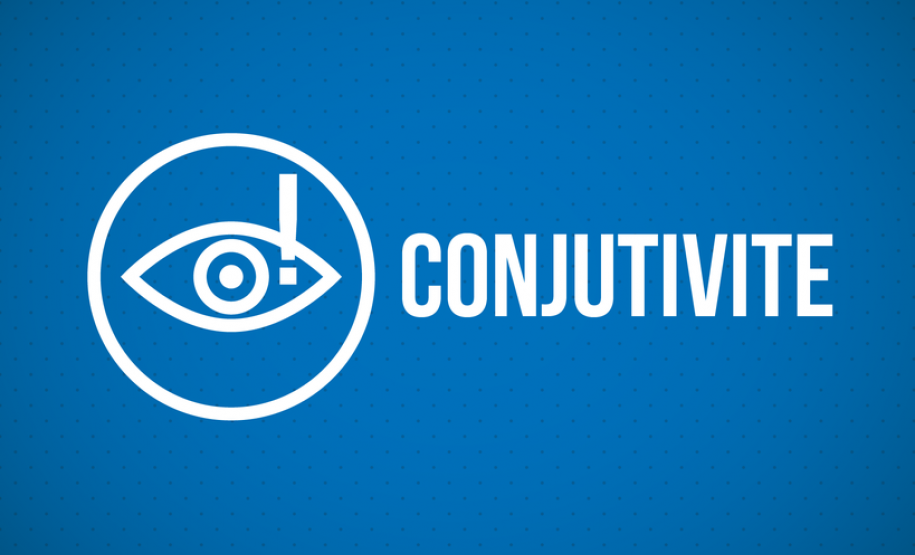 Saúde alerta população sobre os cuidados com conjuntivite Saúde alerta população sobre os cuidados com conjuntivite