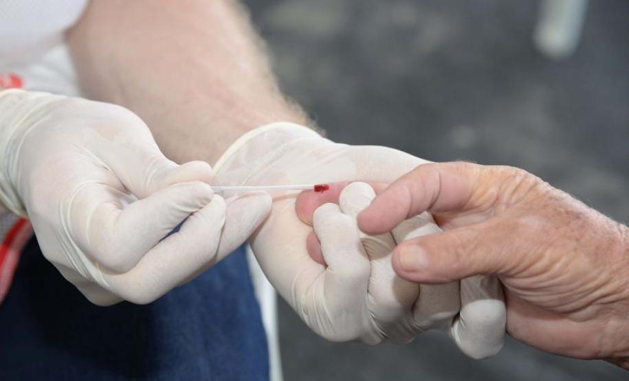 Secretaria da Saúde alerta sobre cuidados com hepatites virais